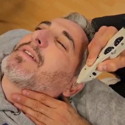 Neuromodulacion-facial-crop