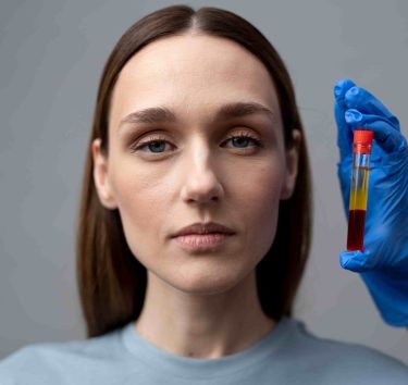 vista-frontal-vial-mujer-y-prp (1)